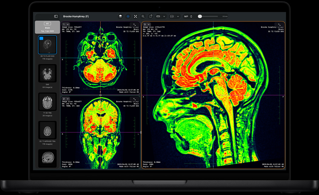 شاشة MacBook Pro تعرض تطبيق Falcon MD‏